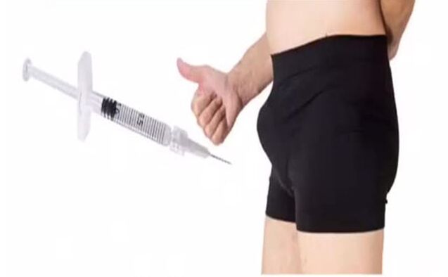 ინექცია პენისში